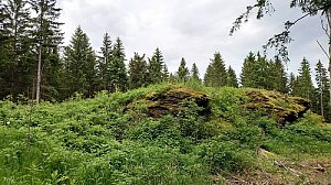 Hirschsprung